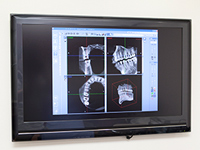 歯科用CTによる撮影で精密な診査・診断